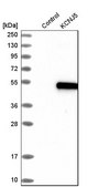 Anti-KCNJ5 antibody produced in rabbit Prestige Antibodies&#174; Powered by Atlas Antibodies, affinity isolated antibody, buffered aqueous glycerol solution