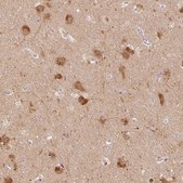 Anti-MAP1LC3A antibody produced in rabbit Prestige Antibodies&#174; Powered by Atlas Antibodies, affinity isolated antibody, buffered aqueous glycerol solution
