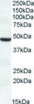 Anti-TMPRSS4 antibody produced in goat affinity isolated antibody, buffered aqueous solution