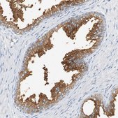 Anti-SYT7 antibody produced in rabbit Prestige Antibodies&#174; Powered by Atlas Antibodies, affinity isolated antibody, buffered aqueous glycerol solution