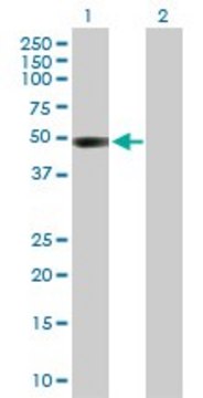 Anti-CTBS antibody produced in rabbit purified immunoglobulin, buffered aqueous solution