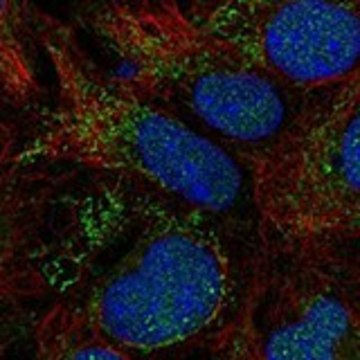 Anti-SLC25A18 antibody produced in rabbit Prestige Antibodies&#174; Powered by Atlas Antibodies, affinity isolated antibody, buffered aqueous glycerol solution