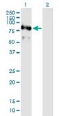 Anti-C1ORF164 antibody produced in mouse purified immunoglobulin, buffered aqueous solution