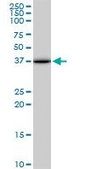 Monoclonal Anti-ACOT7, (N-terminal) antibody produced in mouse clone 1E7, purified immunoglobulin, buffered aqueous solution