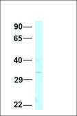 Anti-PITX3 antibody produced in rabbit affinity isolated antibody