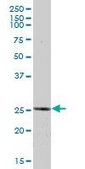 Anti-ETHE1 antibody produced in mouse IgG fraction of antiserum, buffered aqueous solution