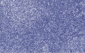 Anti-Caspase-1 p10 Antibody, clone 9H11 ZooMAb&#174; Rabbit Monoclonal recombinant, expressed in HEK 293 cells