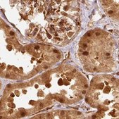 Anti-PSMD1 antibody produced in rabbit Prestige Antibodies&#174; Powered by Atlas Antibodies, affinity isolated antibody, buffered aqueous glycerol solution