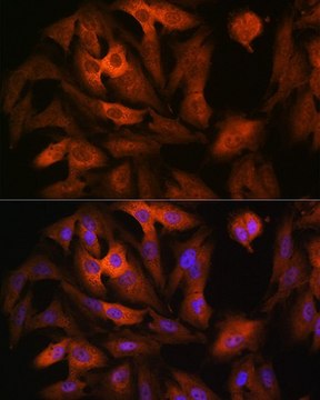 Anti-AGR2 antibody produced in rabbit