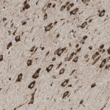 Anti-ST3GAL2 antibody produced in rabbit Prestige Antibodies&#174; Powered by Atlas Antibodies, affinity isolated antibody, buffered aqueous glycerol solution