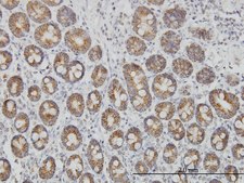 Monoclonal Anti-TOMM20 antibody produced in mouse clone 4F3, purified immunoglobulin, buffered aqueous solution