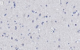 Anti-Histone H2B Antibody, clone 1L5 ZooMAb&#174; Rabbit Monoclonal recombinant, expressed in HEK 293 cells