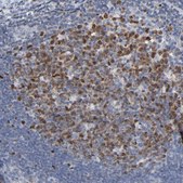 Anti-BIRC3 antibody produced in rabbit Prestige Antibodies&#174; Powered by Atlas Antibodies, affinity isolated antibody, buffered aqueous glycerol solution