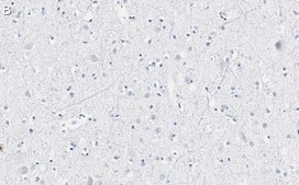 Anti-VGLUT2 Antibody, clone 8G9.2 ZooMAb&#174; Mouse Monoclonal recombinant, expressed in HEK 293 cells