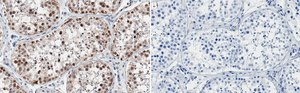 Anti-Ataxin-3 Antibody, clone 2C14 ZooMAb&#174; Rabbit Monoclonal recombinant, expressed in HEK 293 cells