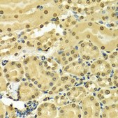 Anti-HNRNPA2B1 antibody produced in rabbit