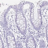 Anti-TNNT1 antibody produced in rabbit Prestige Antibodies&#174; Powered by Atlas Antibodies, affinity isolated antibody, buffered aqueous glycerol solution