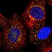 Anti-TMEM87B antibody produced in rabbit Prestige Antibodies&#174; Powered by Atlas Antibodies, affinity isolated antibody, buffered aqueous glycerol solution