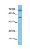 Anti-IFIT3 antibody produced in rabbit affinity isolated antibody