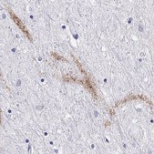 Anti-CCK Prestige Antibodies&#174; Powered by Atlas Antibodies, affinity isolated antibody