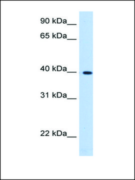 Anti-LIAS antibody produced in rabbit affinity isolated antibody