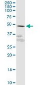 Anti-GPR61 antibody produced in mouse purified immunoglobulin, buffered aqueous solution