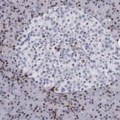 Anti-WAS antibody produced in rabbit Prestige Antibodies&#174; Powered by Atlas Antibodies, affinity isolated antibody, buffered aqueous glycerol solution