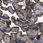 Anti-TRIOBP antibody produced in rabbit Prestige Antibodies&#174; Powered by Atlas Antibodies, affinity isolated antibody, buffered aqueous glycerol solution