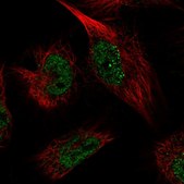 Anti-PDXK antibody produced in rabbit Prestige Antibodies&#174; Powered by Atlas Antibodies, affinity isolated antibody, buffered aqueous glycerol solution, ab2