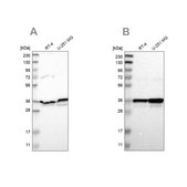 Anti-ANXA1 antibody produced in rabbit Prestige Antibodies&#174; Powered by Atlas Antibodies, affinity isolated antibody, buffered aqueous glycerol solution