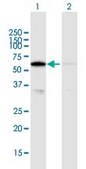 Anti-CAT antibody produced in mouse purified immunoglobulin, buffered aqueous solution