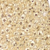 Anti-ASC/TMS1 antibody produced in rabbit