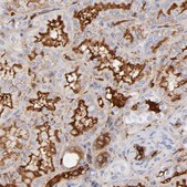 Anti-C3 antibody produced in rabbit Prestige Antibodies&#174; Powered by Atlas Antibodies, affinity isolated antibody, buffered aqueous glycerol solution