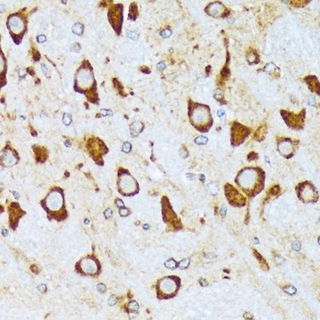 Anti-COPA antibody produced in rabbit