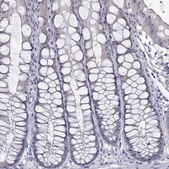 Anti-PADI1 antibody produced in rabbit Prestige Antibodies&#174; Powered by Atlas Antibodies, affinity isolated antibody, buffered aqueous glycerol solution