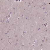 Anti-PKP3 antibody produced in rabbit Prestige Antibodies&#174; Powered by Atlas Antibodies, affinity isolated antibody, buffered aqueous glycerol solution