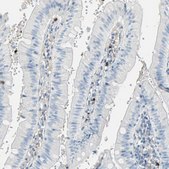 Anti-CLEC4A antibody produced in rabbit Prestige Antibodies&#174; Powered by Atlas Antibodies, affinity isolated antibody, buffered aqueous glycerol solution