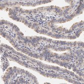 Anti-DDX3X antibody produced in rabbit Ab1, Prestige Antibodies&#174; Powered by Atlas Antibodies, affinity isolated antibody, buffered aqueous glycerol solution