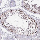 Anti-SIN3A antibody produced in rabbit Prestige Antibodies&#174; Powered by Atlas Antibodies, affinity isolated antibody, buffered aqueous glycerol solution