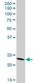 Anti-PYCARD, (N-terminal) antibody produced in mouse purified immunoglobulin, buffered aqueous solution