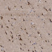 Anti-ITM2B antibody produced in rabbit Prestige Antibodies&#174; Powered by Atlas Antibodies, affinity isolated antibody, buffered aqueous glycerol solution
