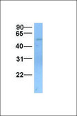 Anti-SLC22A11 (AB1) antibody produced in rabbit affinity isolated antibody