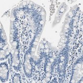 Anti-CA1 antibody produced in rabbit Prestige Antibodies&#174; Powered by Atlas Antibodies, affinity isolated antibody, buffered aqueous glycerol solution