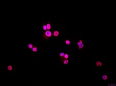 MCF-7 BUS Human Invasive Ductal Carcinoma Cell Line