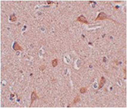 Anti-SIPA1L1 Antibody from rabbit, purified by affinity chromatography