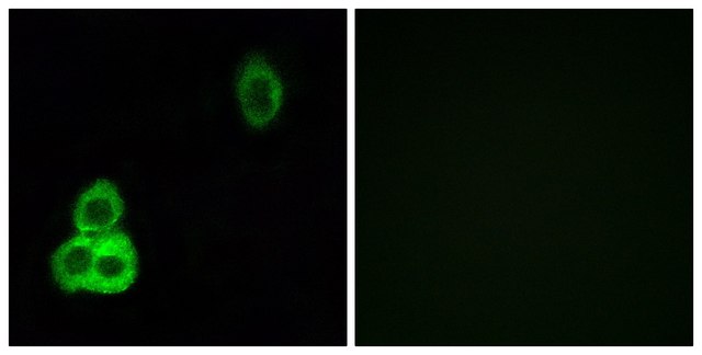 Anti-CELSR1 antibody produced in rabbit affinity isolated antibody