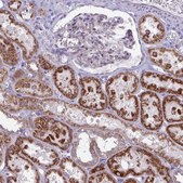 Anti-GLDC antibody produced in rabbit Prestige Antibodies&#174; Powered by Atlas Antibodies, affinity isolated antibody, buffered aqueous glycerol solution