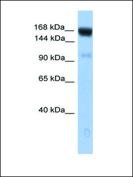 Anti-UBE4B antibody produced in rabbit affinity isolated antibody