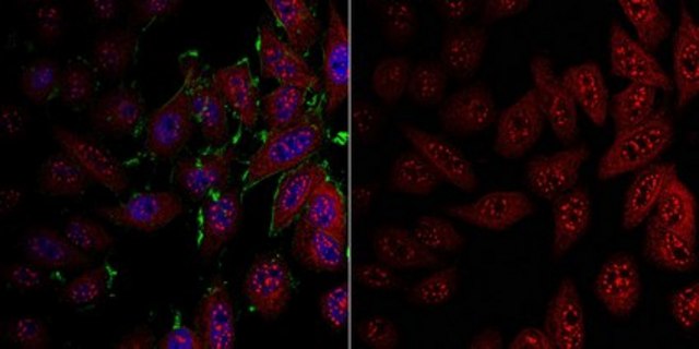 Anti-LDHA from rabbit, purified by affinity chromatography