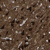 Anti-LRIG1 antibody produced in rabbit Prestige Antibodies&#174; Powered by Atlas Antibodies, affinity isolated antibody, buffered aqueous glycerol solution
